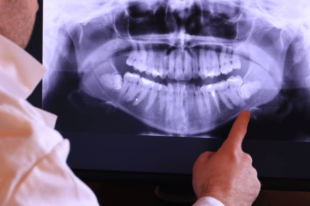 Best Pediatric Emergency Dentist in Lattingtown, NY